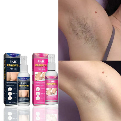 Semi-permanent Hair Removal Spray