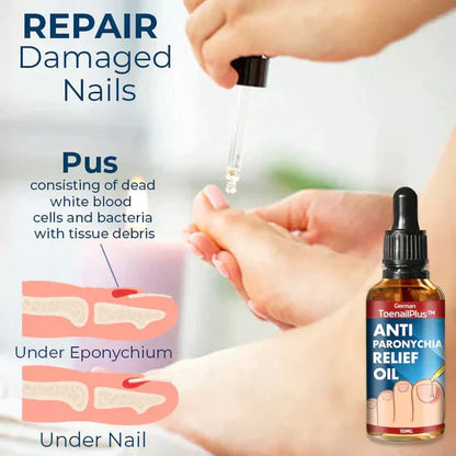 German ToenailPlus™ Anti Paronychia Relief Oil